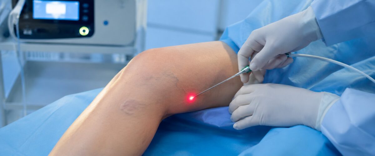 Lasertherapie Venös
